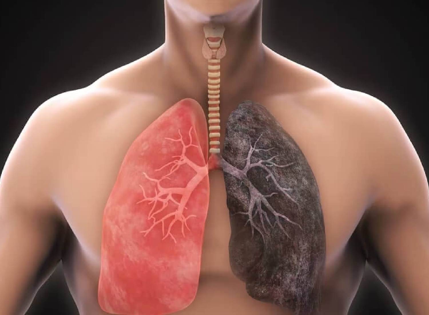 Respiratory Health